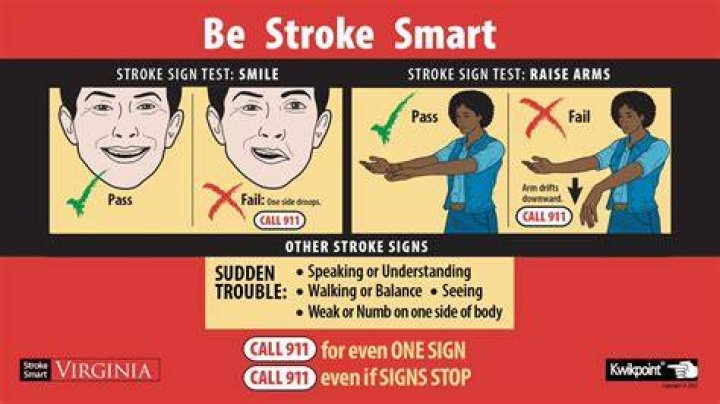 Is there a test to see if you had a stroke?