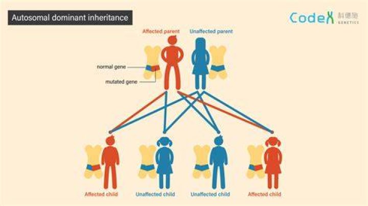 Should parents split inheritance equally?