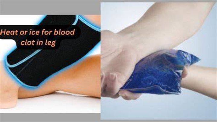 Should you ice a leg with a blood clot?