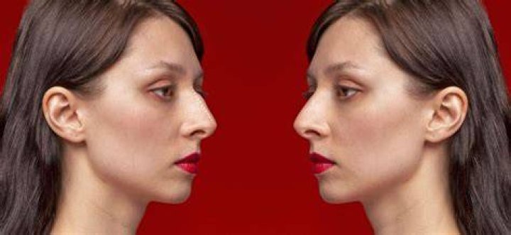 What affects nose shape?