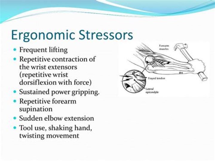 What are ergonomic stressors?