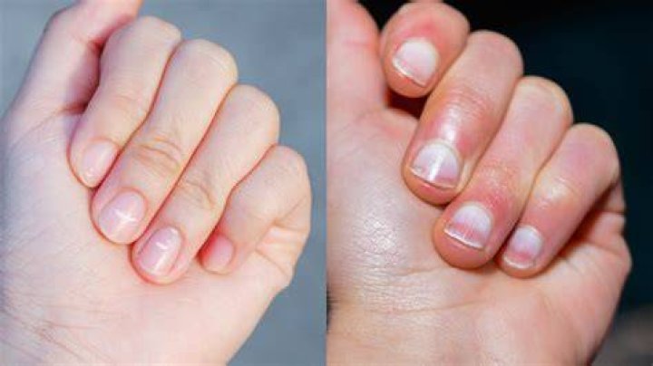 What are good Nailbeds?