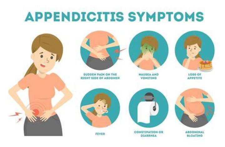 What are signs you need your appendix out?