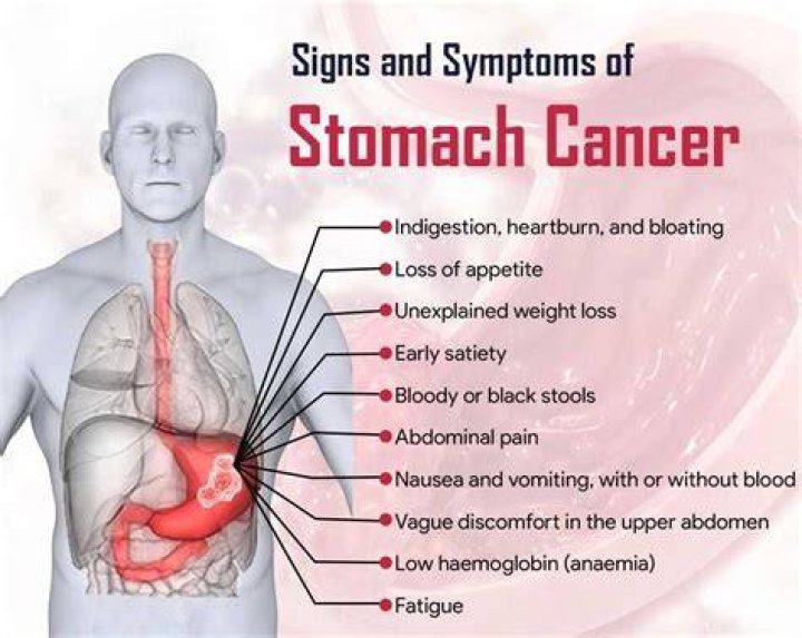What are symptoms of stomach tumors?