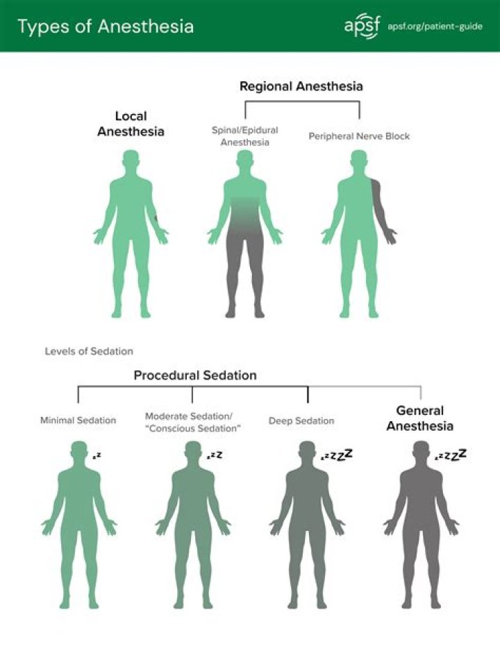 What are the 3 types of anesthesia?