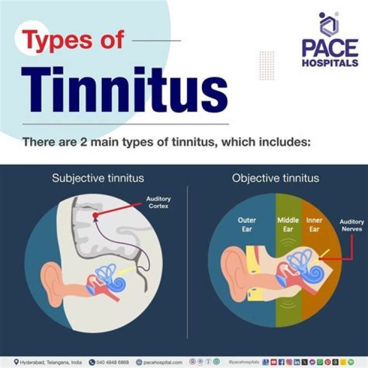 What are the 4 types of tinnitus?