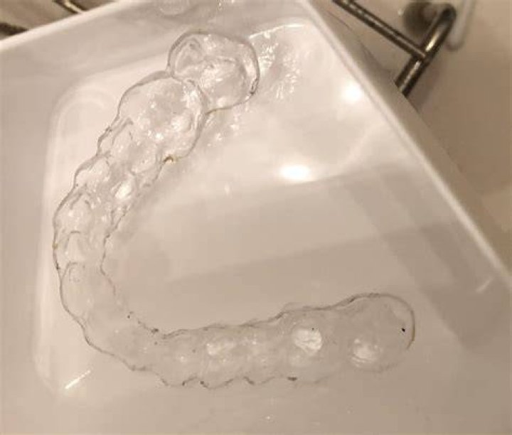 What are the black dots on my retainer?
