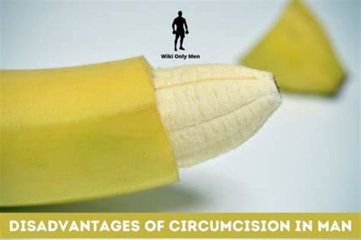 What are the disadvantages of male circumcision?