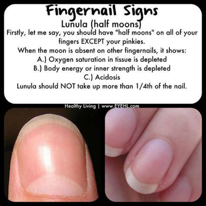 What are the half moons on fingernails?