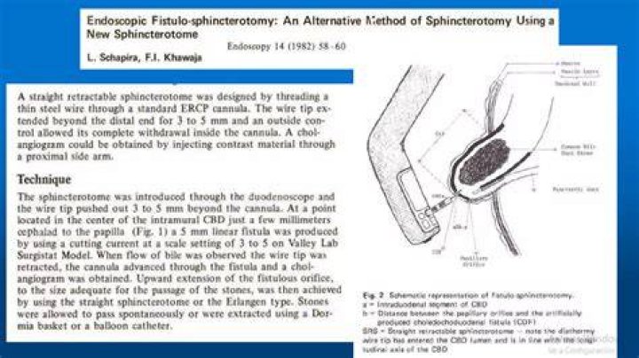 What are the risks of sphincterotomy?