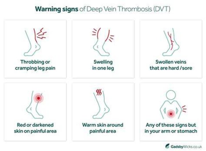 What are the warning signs of deep vein thrombosis?