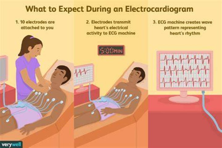 What can an electrocardiogram diagnose?