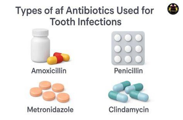 What can I take instead of antibiotics for tooth infection?