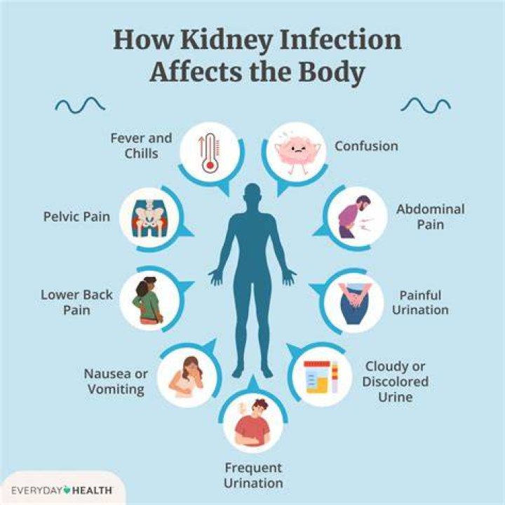 What can mimic kidney infection?