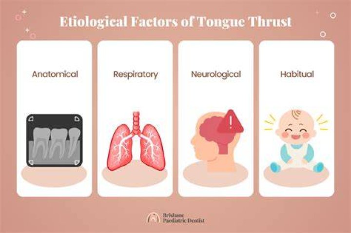 What causes a tongue thrust?