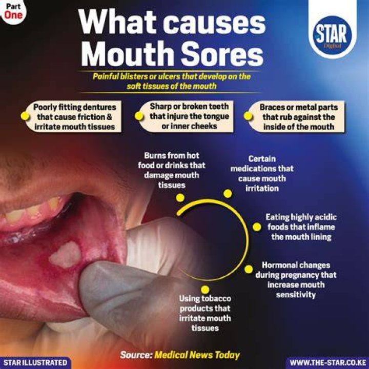 What causes bass sores?