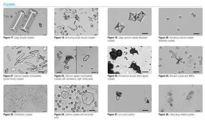 What causes cat crystals?