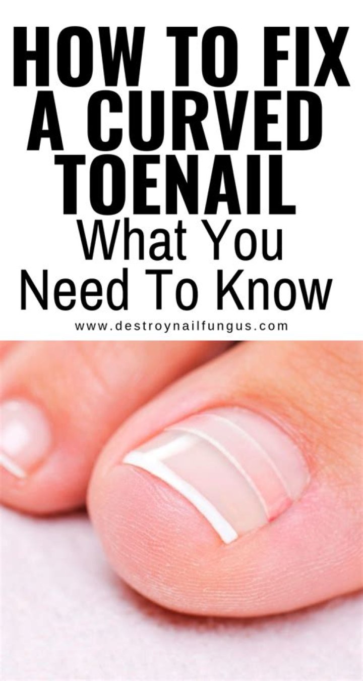 What causes curved toenails?