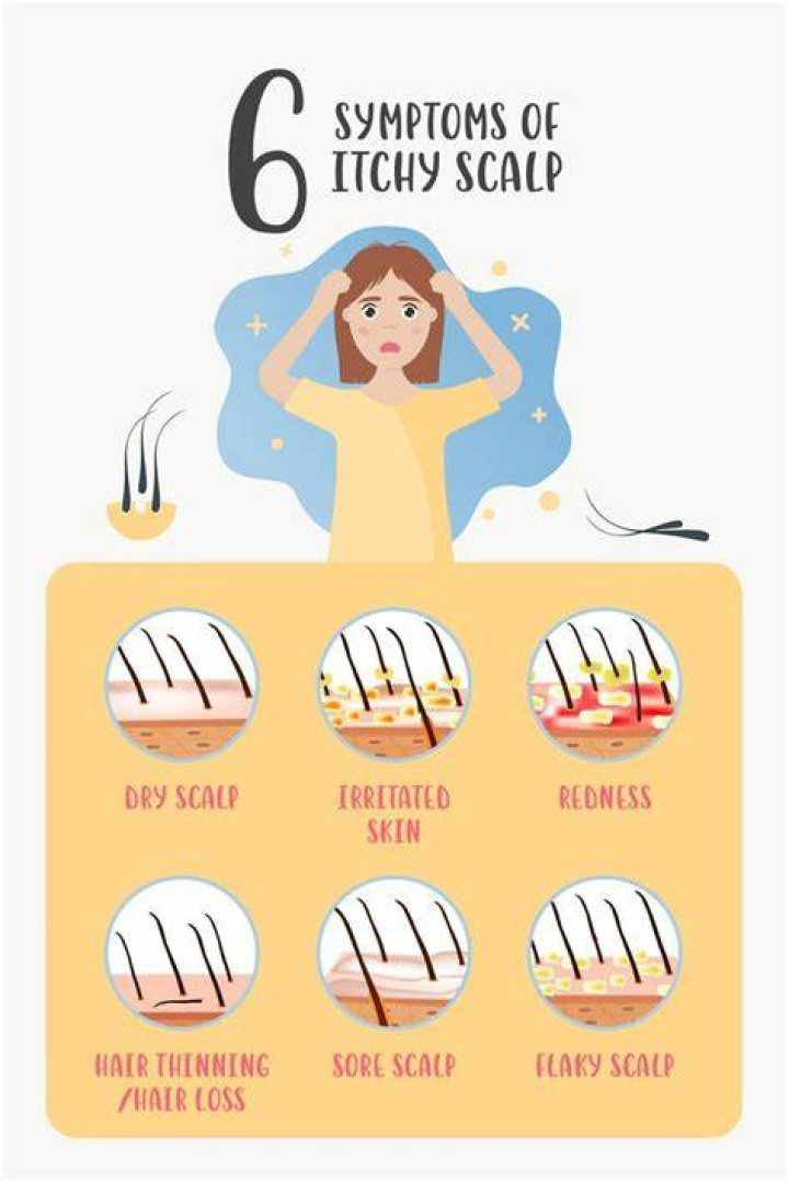 What causes itchy scalp at night?