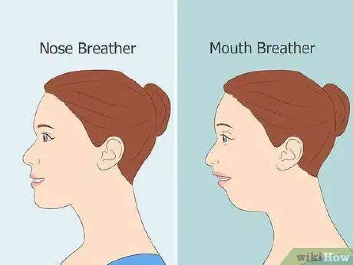 What causes open mouth posture?