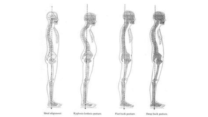 What causes the body to be out of alignment?