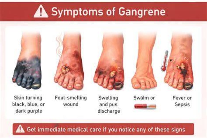 What color is gangrene?
