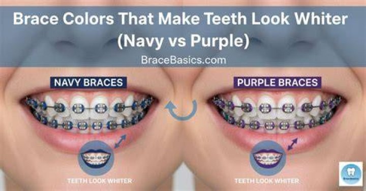 What color shirt makes teeth look whiter?