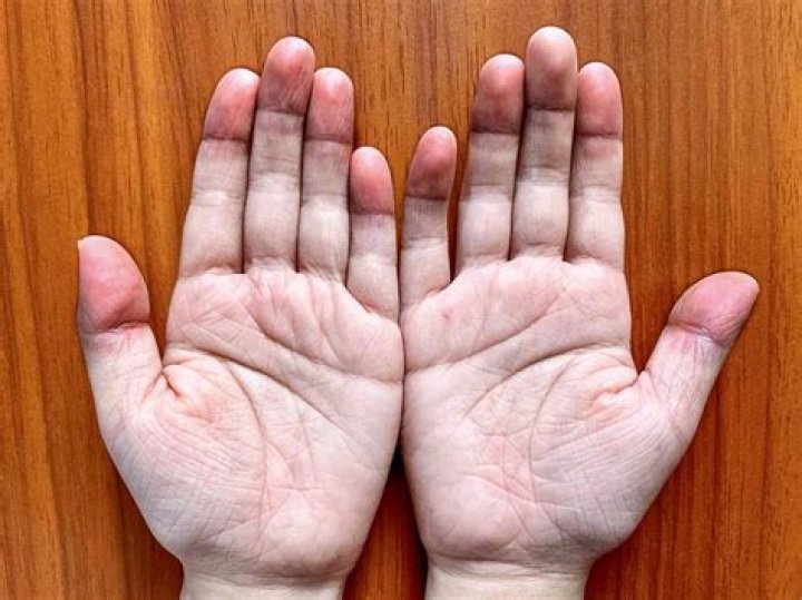 What color should your palms be?