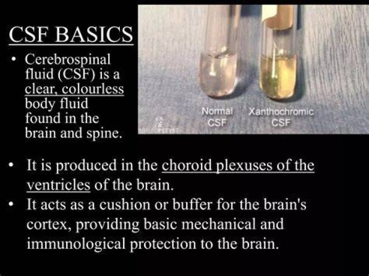 What Colour is brain fluid?