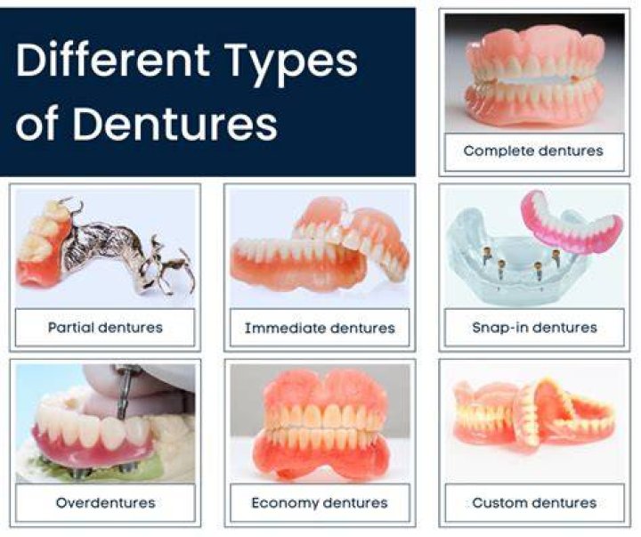What dentures are the best?