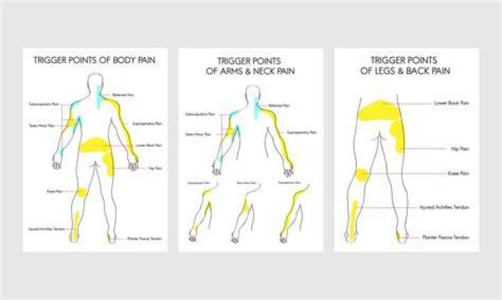 What did 1912 mean in Trigger Point?