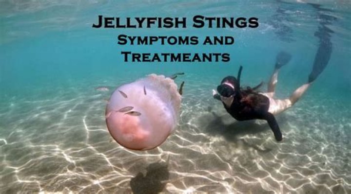 What do fishermen do with jellyfish?