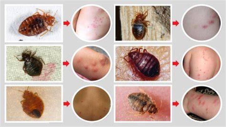 What does a bed bug bite look like?