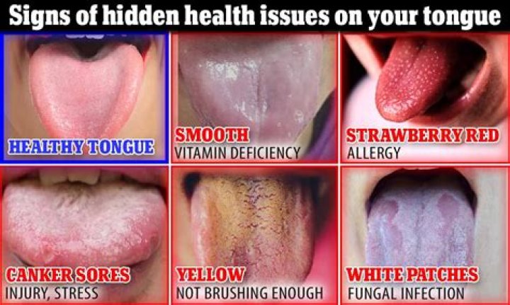 What does a dirty tongue mean?