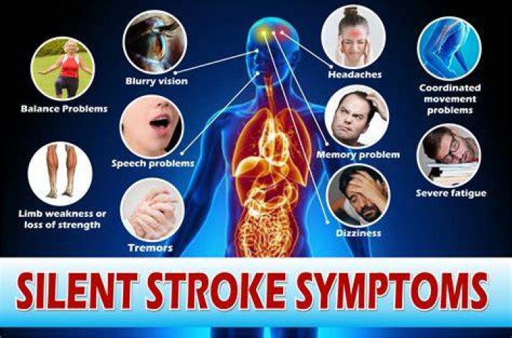 What does a silent stroke feel like?