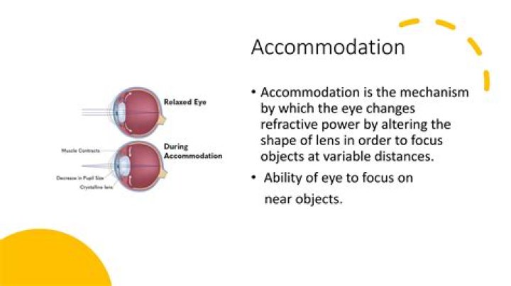 What does accommodation Street mean?