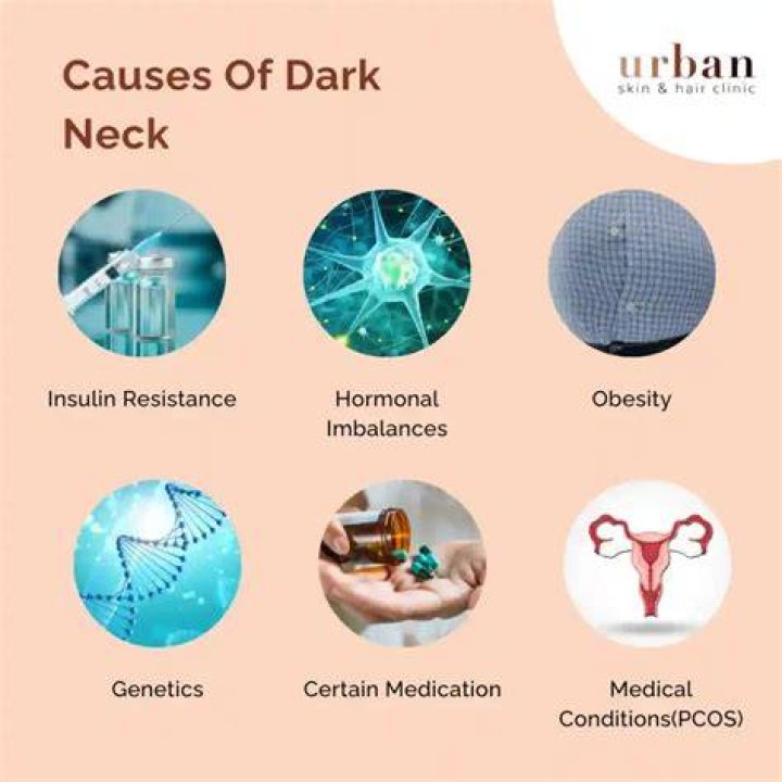 What does Black neck mean?