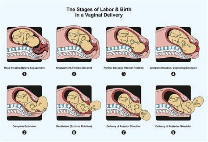 What does delivering a baby feel like?