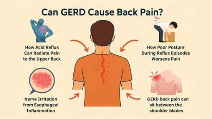 What does GERD back pain feel like?