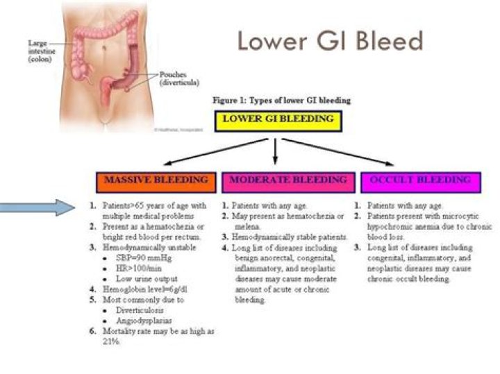 What does GI bleed smell like?