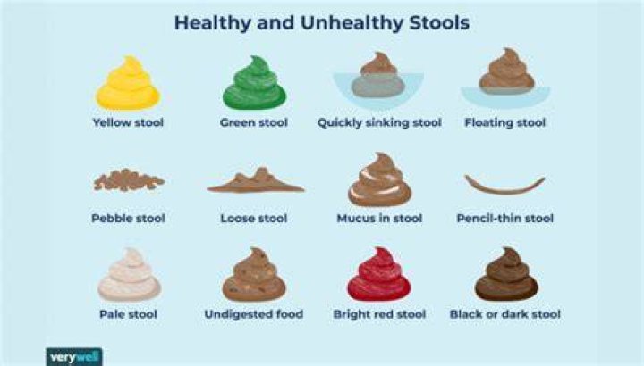 What does it mean when your poop smells terrible?