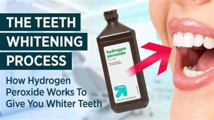 What does peroxide do to your teeth?