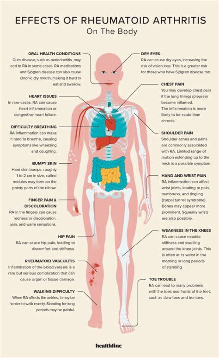 What does RA pain feel like?