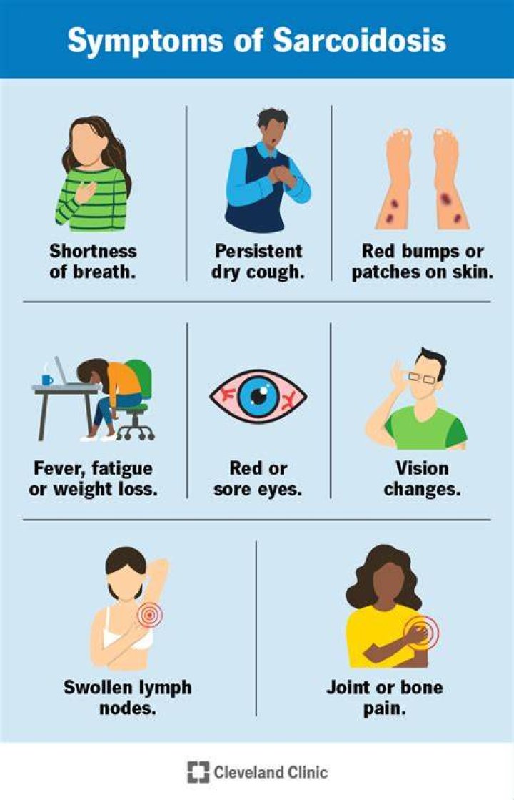 What does sarcoidosis fatigue feel like?