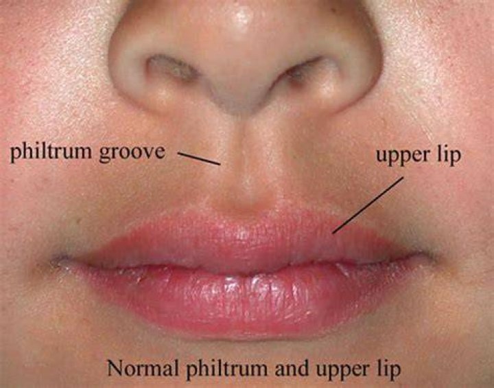 What does your philtrum say about you?