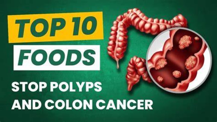 What foods cause polyps?