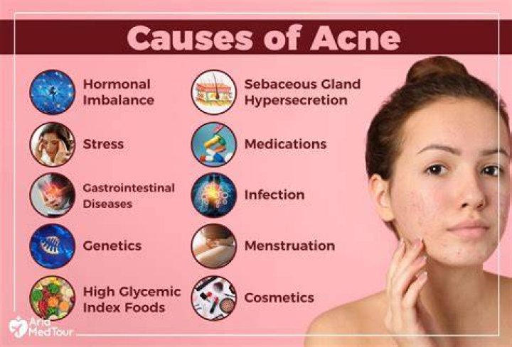 What gynecological problems cause acne?