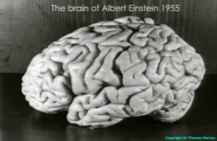 What happened to Albert Einstein's brain?