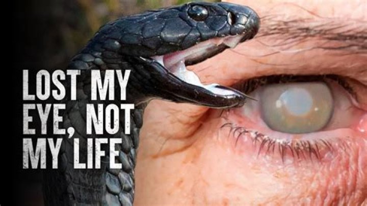 What happens if a cobra spits in your eyes?