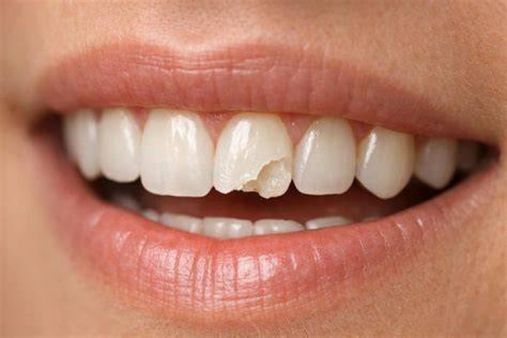 What happens if you leave a broken tooth?